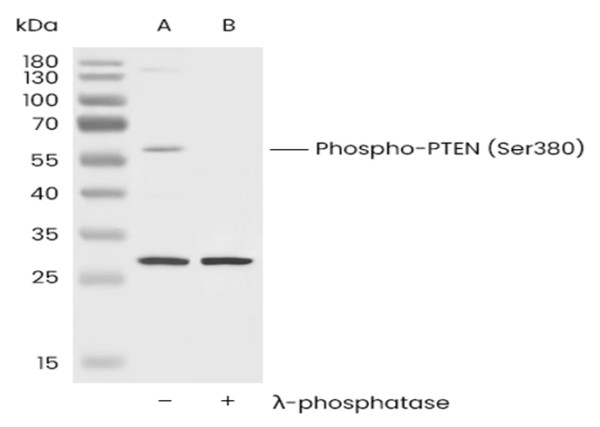 Anti-Phospho-PTEN (Ser380) Monoclonal Recombinant Antibody