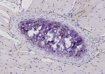 Anti-S100A1 Monoclonal Recombinant Antibody