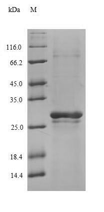 N (4)- (beta-N-acetylglucosaminyl)-L-asparaginase (AGA), partial, human, recombinant