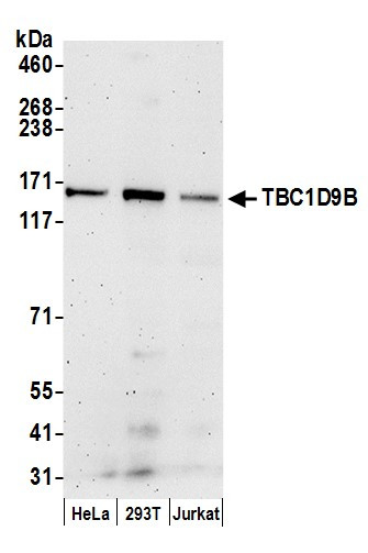 Anti-TBC1D9B