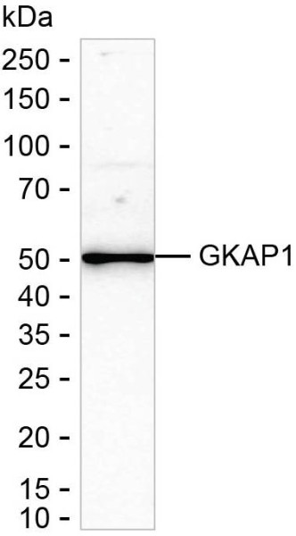 Anti-GKAP1
