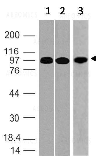 Anti-RANK (CD265, TNF11aR, ODFR) (Clone: ABM10D5)