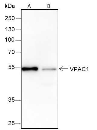 Anti-Recombinant VPAC1, clone A390