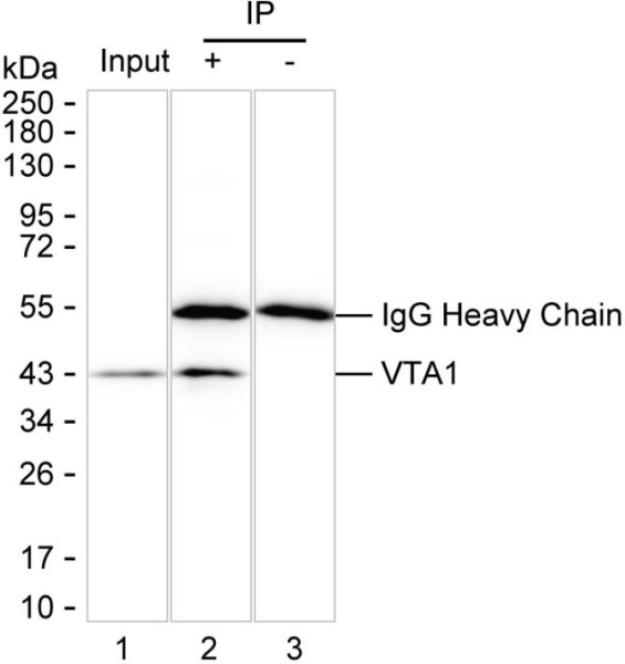 Anti-VTA1