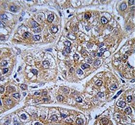 Anti-AKR1A1 / Aldehyde Reductase