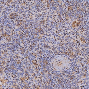 Anti-ITK / IL2-inducible T-cell kinase
