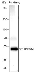 Anti-Recombinant TMPRSS2, clone A380