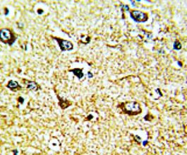 Anti-Tyrosine Hydroxylase