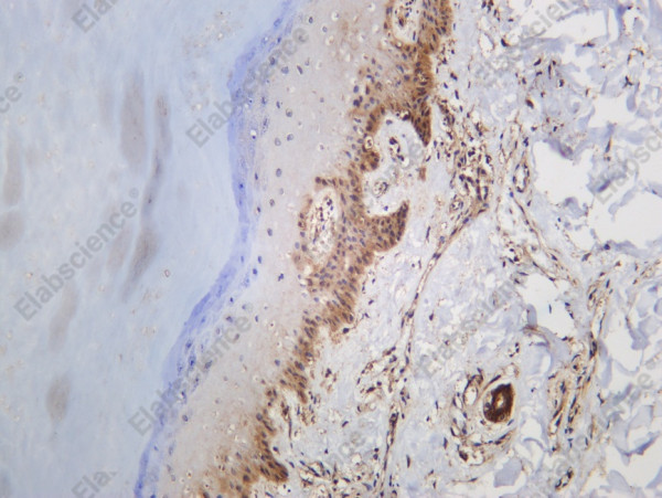 Anti-Recombinant UBC9, clone C112406