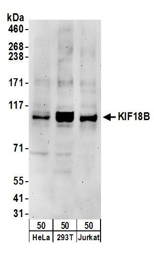 Anti-KIF18B
