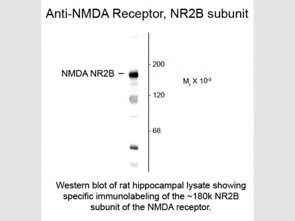 Anti-NMDA R2B