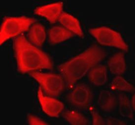 Anti-alpha Synuclein