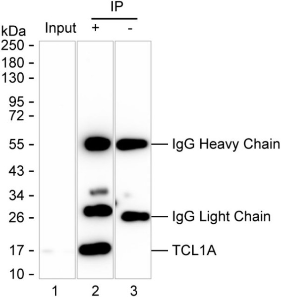 Anti-T Cell Leukemia/Lymphoma Protein 1A