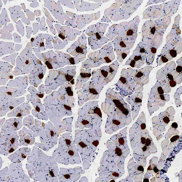 Anti-MYL2