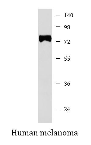 Anti-TRP1