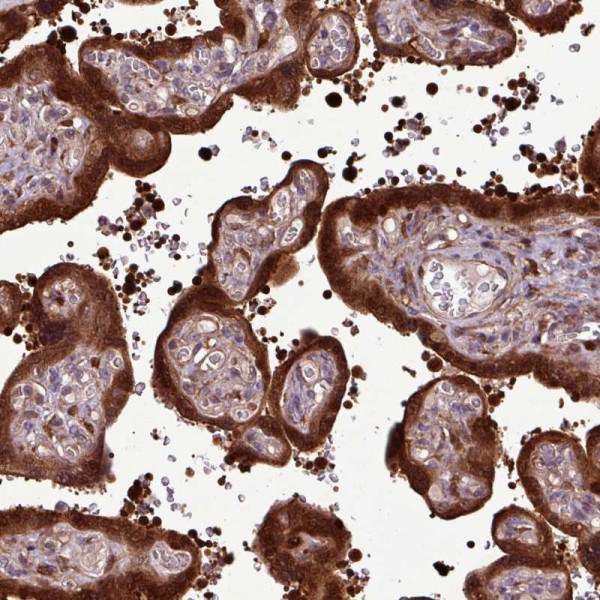 Anti-CARHSP1