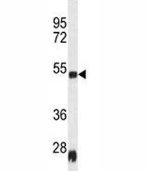 Anti-Hsp47 / Serpin H1, clone 134CT3.1.1