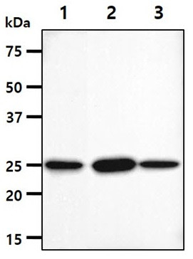 Anti-NQO2, clone 7G7