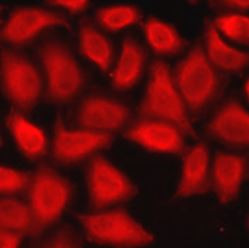 Anti-PSMA3