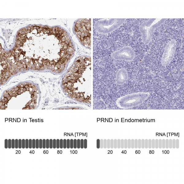 Anti-PRND
