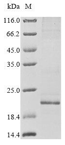 Gap junction alpha-1 protein (GJA1), partial, human, recombinant