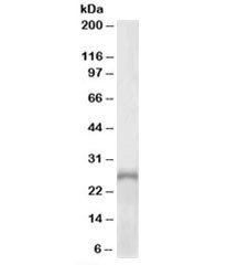 Anti-PHOX2A