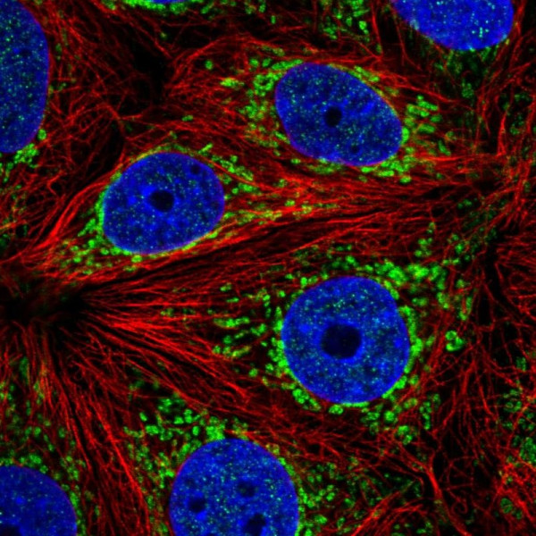 Anti-ATP5J2