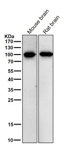 Anti-phospho-Beta Catenin (Thr41/Ser45), clone 32C69