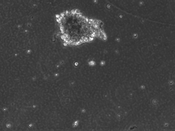 B-LCL-HROC117 (Bc HROC117) Cells