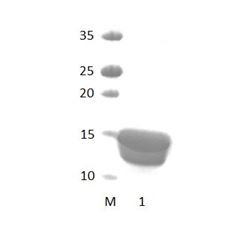 NHERF2_2 PDZ Domain