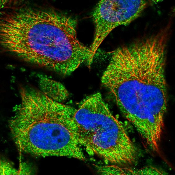 Anti-PSMA5