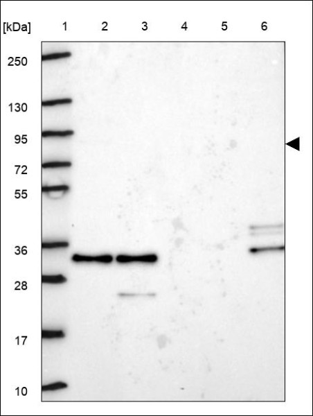 Anti-KLHL22