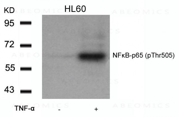 Anti-phospho-NFkB-p65 (Thr505)