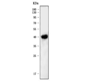 Anti-Nfkbie / IKB epsilon