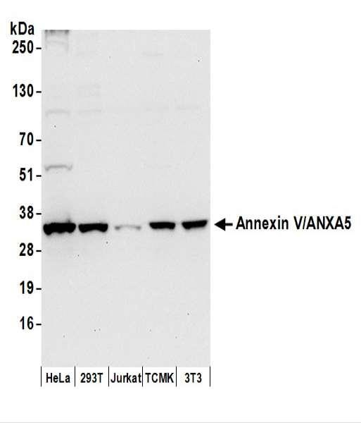Anti-Annexin V/ANXA5