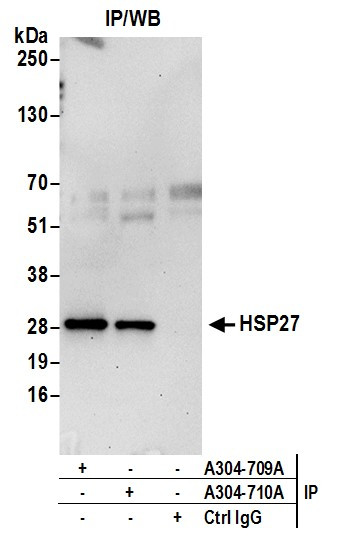 Anti-HSP27