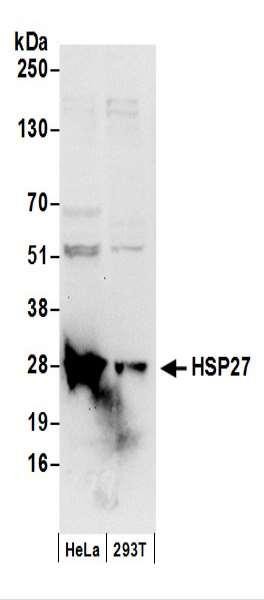 Anti-HSP27