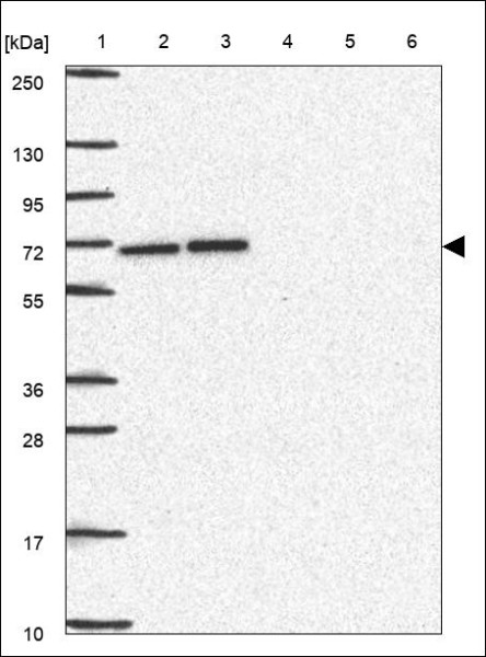 Anti-CCT3