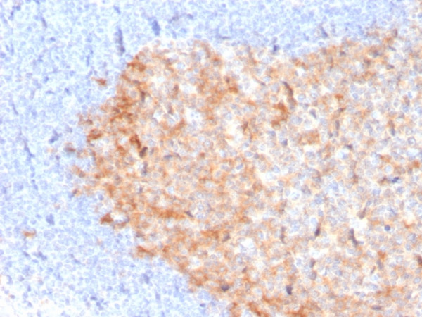Anti-CD86 (Dendritic Cells Maturation Marker), clone C86/3713