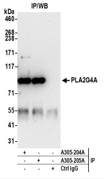 Anti-PLA2G4A/cPLA2