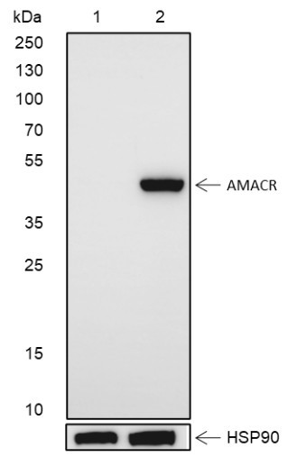Anti-Recombinant AMACR, clone A110