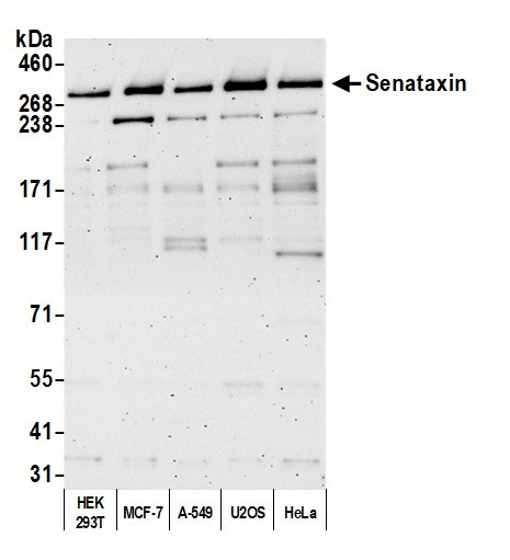 Anti-Senataxin