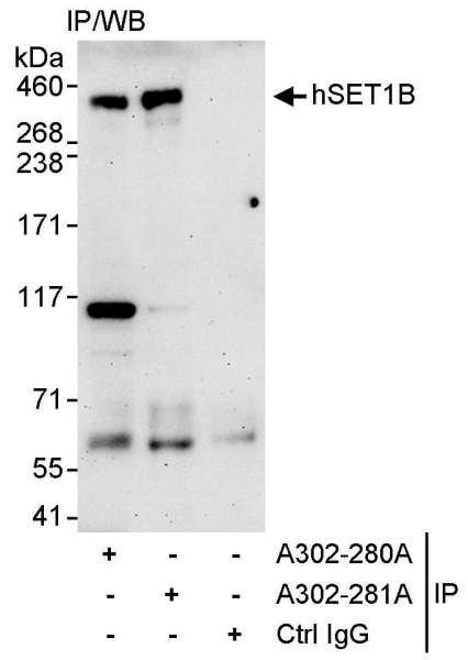 Anti-hSET1B