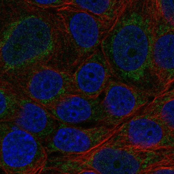 Anti-CYP11B2