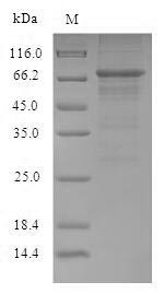 Nucleoprotein (NP), Influenza A virus, recombinant