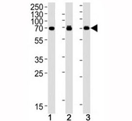 Anti-S6K2, clone 164CT21.2.2