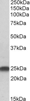 Anti-LIN7B, N-terminal