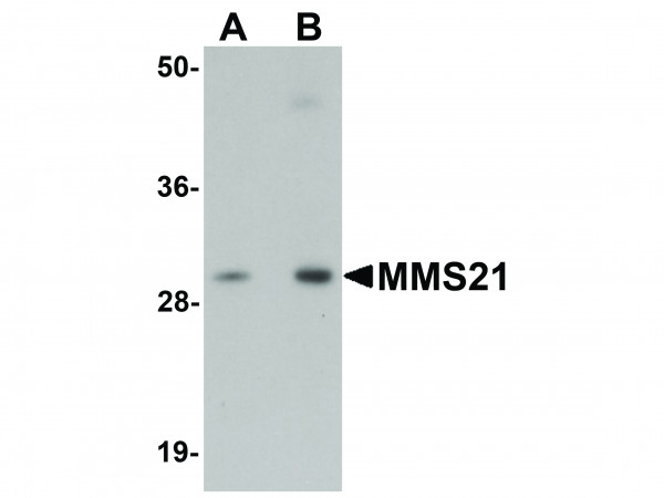 Anti-MMS21