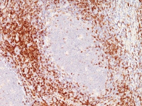 Anti-CD6 (Negative Marker of T-regulatory Cells), clone SPM547