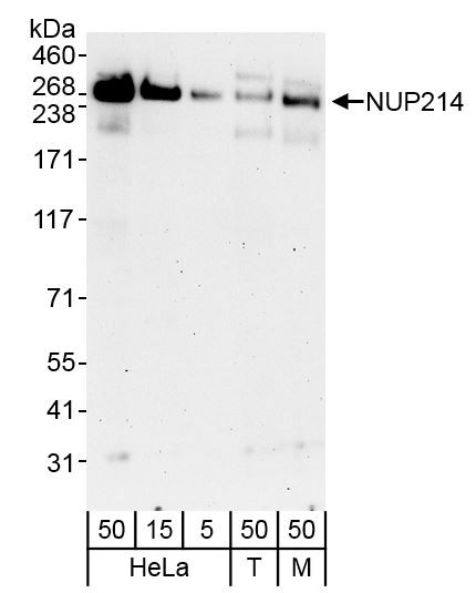 Anti-NUP214